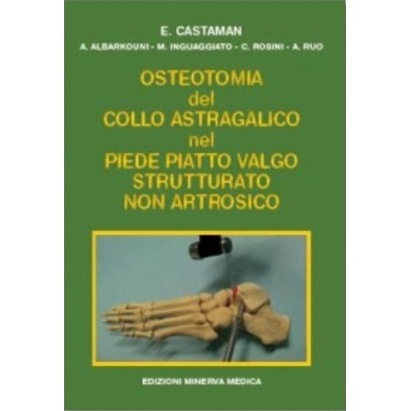 Osteotomia del collo astragalico nel piede piatto valgo strutturato non artrosico